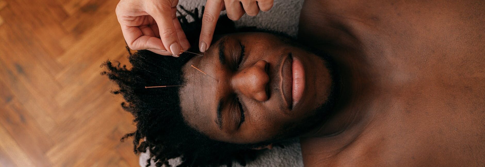 person putting needles on the forehead of a man