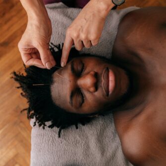 person putting needles on the forehead of a man