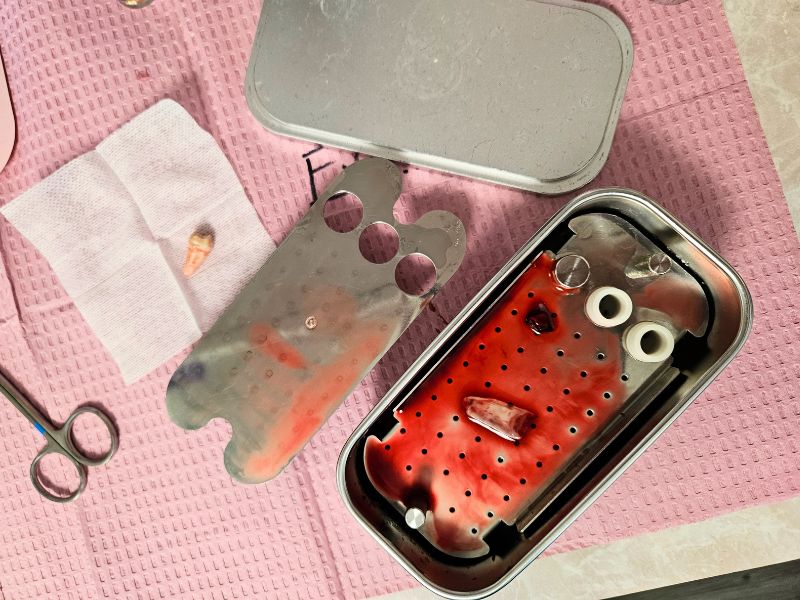Cover image for a Mindful Doctor Instagram video about dental surgical care