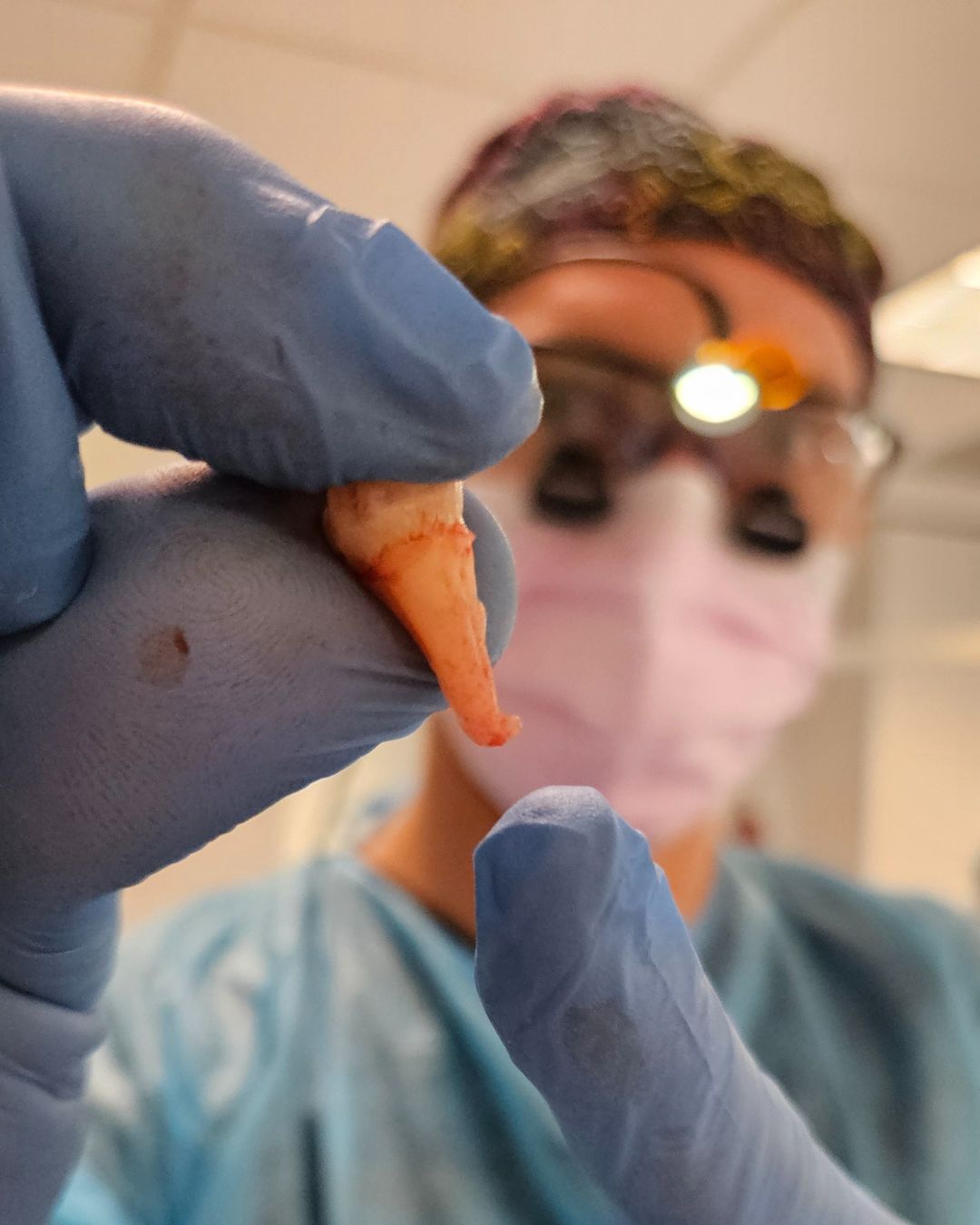 Cover image for a Mindful Doctor Instagram video about oral surgery and PRF