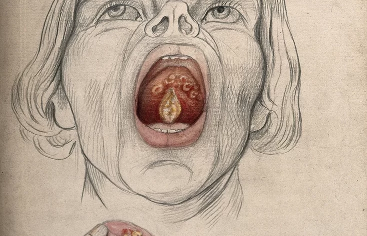 face man, mouth open wide